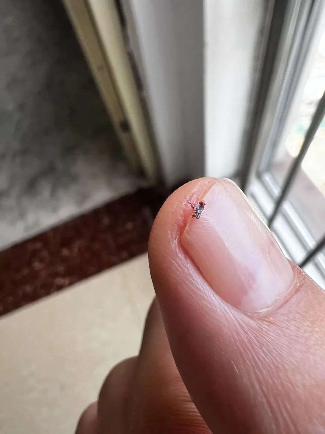 抓跳蚤什么意思_抓跳蚤的工具_专业抓跳蚤