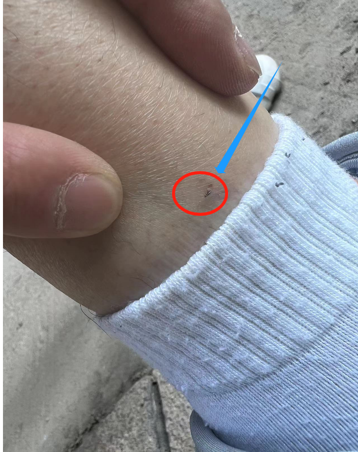 专业抓跳蚤_抓跳蚤什么意思_抓跳蚤的工具