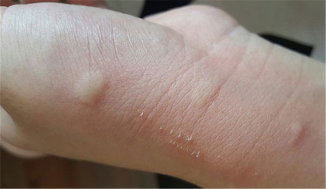 蚊子的药水_药水子灭蚊有什么作用_灭蚊子的药水有哪些