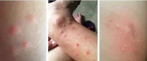 灭蚊子表情包_灭蚊子图片_灭蚊图片表情包