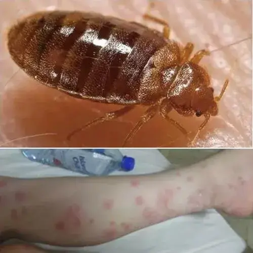 臭虫最有效的方法_臭虫有效方法有哪些_臭虫有效方法是什么