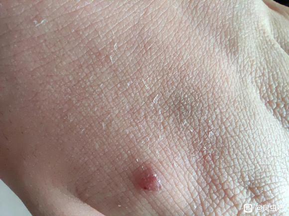 臭虫杀虫药_灭臭虫的药_杀臭虫的药粉