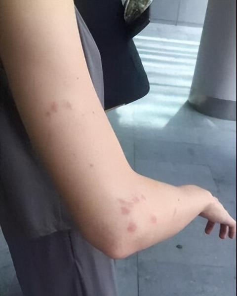 灭臭虫公司种类_灭臭虫公司费用_灭臭虫公司